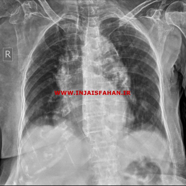 رادیولوژی در منزل در اصفهان