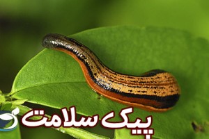 زالو ، خواص و روش درمانی با آن 